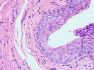 picture of histology human tissue with microscope from laboratory (not Illustration Designation)