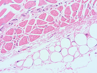 picture of histology human tissue with microscope from laboratory (not Illustration Designation)