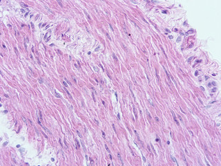 picture of histology human tissue with microscope from laboratory (not Illustration Designation)