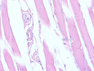 picture of histology human tissue with microscope from laboratory (not Illustration Designation)