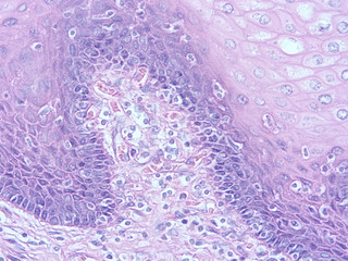 picture of histology human tissue with microscope from laboratory (not Illustration Designation)