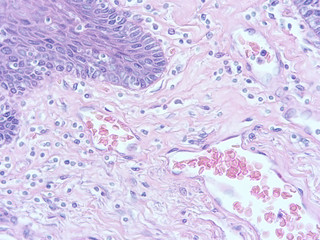 picture of histology human tissue with microscope from laboratory (not Illustration Designation)