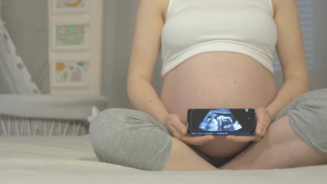 A pregnant woman is holding a smartphone with an unborn baby on the screen, baby moves in moms stomach. The nine months of pregnancy, conceptual footage
