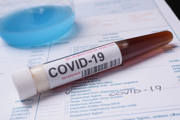 Covid-19 test tube
