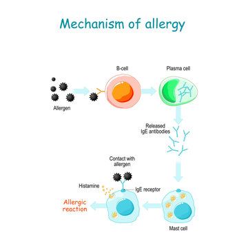 Mechanism of allergy.