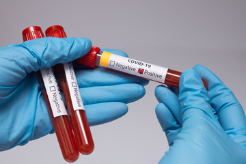 Fototapeta premium Blood positive test to coronavirus. Medical reseach, test-tube with blood, hand in latex medical gloves. Coronavirus outbreak and influenza. 2019-nCoV, covid-19, sars. High quality photo. 