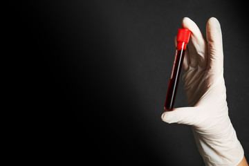 Scientist holding test tube of blood sample on black background, closeup with space for text. Virus...