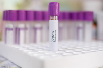 Covid-19 Blood Sample on test Tube Background