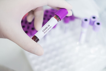 Asian male doctor holding Covid-19 Blood Sample on White Background