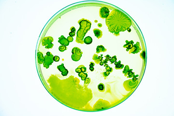 Mixed of bacteria colonies and fungus in various petri dish
