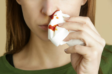 Nosebleed, a young woman with a bloody nose. Healthcare and medical concept. Close up studio image.