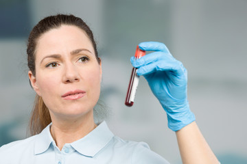 nurse is looking at blood sample in a test tube