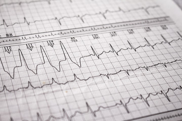 Heartbeat represented on paper. Cardiac arrhythmias. Selective focus on some beats. Free space to write.