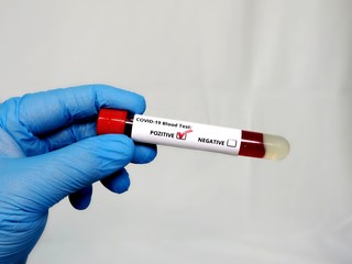 Obraz premium Blood test, Covid-19, China Wuhan Coronavirus