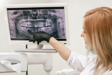 girl dentist points a finger at a sick tooth in radiography