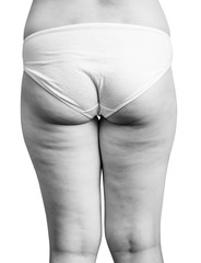 Fat and flabby female buttocks with cellulite.