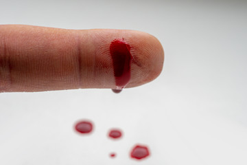 bleeding finger