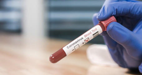 Obraz premium Coronavirus COVID-19 Infected Blood Sample in Doctor Scientist Hands. Epidemic and Virus Outbreak.