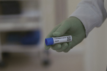 Corona Virus in Lab. New Epidemic Coronavirus 2019 nCoV, fear of a coronavirus pandemic, hand with...