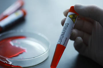 A blood sample for testing the dangerous virus coronavirus in the body. Test tubes with tests for coronavirus. Laboratory studies of viral diseases.