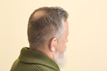 Senior man with hair loss problem on color background