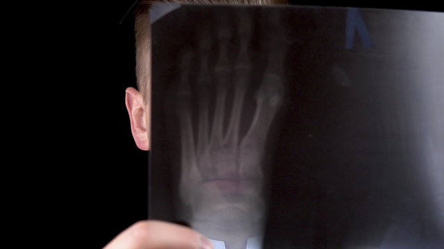 Young man doctor checks the results of an x-ray of the foot. A man is considering a close-up x-ray. On a black background. View through an x-ray image.