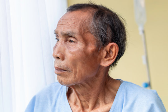 Senior Man Patient Thinking And Dream About Life On Hospital Bed.