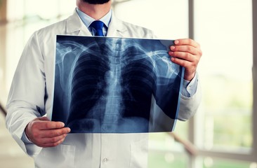 Lung.
