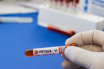 Obraz premium blood test tube to examine the corona virus
