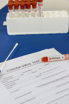 blood test tube to examine the corona virus