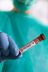 Doctor holds a blood test tube to examine the corona virus