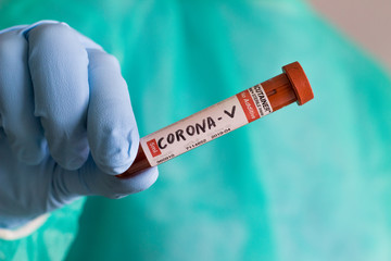 Doctor holds a blood test tube to examine the corona virus