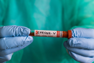 Doctor holds a blood test tube to examine the corona virus