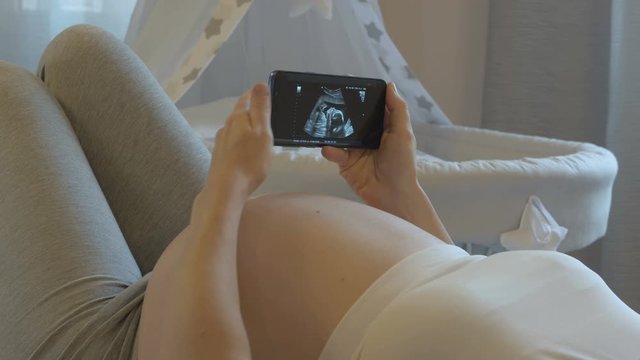 Pregnant woman holds a phone in her hands with a ultrasound exam of her unborn child, modern medical technology, ultrasound examination of the fetus