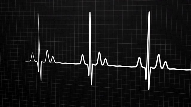 Loopable: White 3D EKG/ECG cardiogram oscilloscope monitor heartbeat line chart shows 60 BPM heart rate on black background with grid.