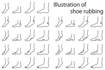 靴擦れのイラストセット１