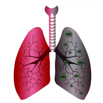 Lungs infections icon. Internal organs of the human design element, logo. Anatomy, lung organ on white background.