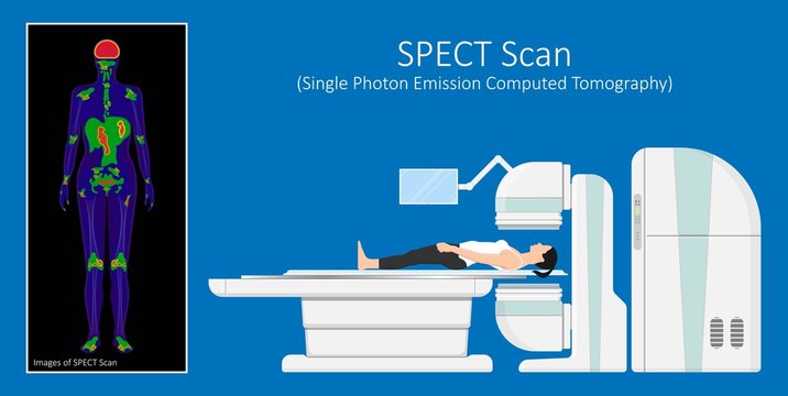 SPECT scan radiologist single computed image CT PET 3D radiotracer Radioiodine I-131 examines uptake treat iodine radiology radioactive diagnosis diagnose radioisotopes radiopharmaceuticals