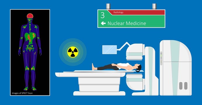 SPECT scan radiologist single computed image CT PET 3D radiotracer Radioiodine I-131 examines uptake treat iodine radiology radioactive diagnosis diagnose radioisotopes radiopharmaceuticals