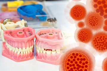 Dentures with human teeth on the table. Figure virus on the dentist's desk background. Infection...