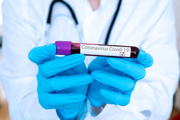 Doctor hand in medical glove  holding tube with positive blood test result for rapidly spreading Coronavirus 2019-nCoV in laboratory.  Coronavirus  Covid-19 outbreaking. Medicine and epidemic concept.