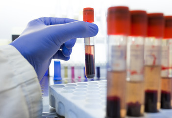Biologist holding test tube with blood sample