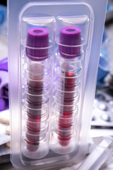 Medical test-tubes with blood samples for screening of virus, flu or bacterial infections and syringe