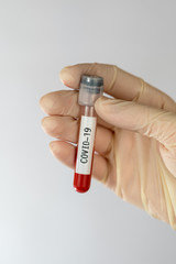 Obraz premium Laboratory sample of blood testing for diagnosis new Corona virus infection (COVID-19) from Wuhan, China. Pandemic infectious concept.