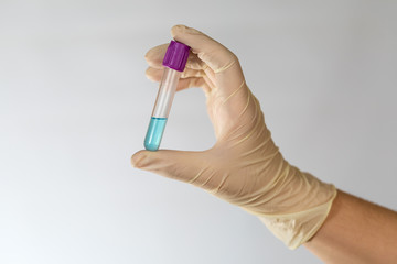 Test tube with blue transparent chemical fluid in the hands of a scientist. Hands in latex gloves. Vacuum test tube.