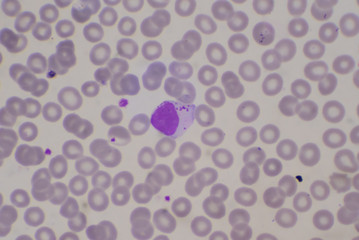 White blood cell lymphocyte on red blood cells background.