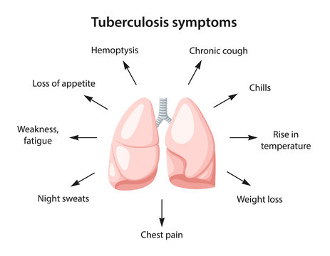 Tuberculosis symptoms as text. Image of human lungs. Vector illustration in flat style isolated over white background.