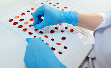 medical laboratory worker holds cuvette for definition of blood type and Rh factor.