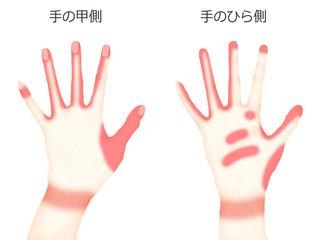 手洗い-洗い残しのイラスト