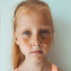 Little ginger girl with pigment on her face and freckles. Children's portrait. Not like everyone...